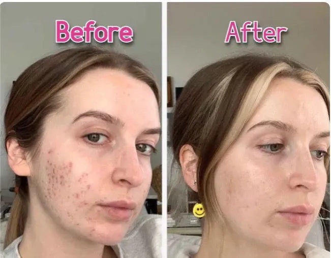 Face Massager Beauty Machine
